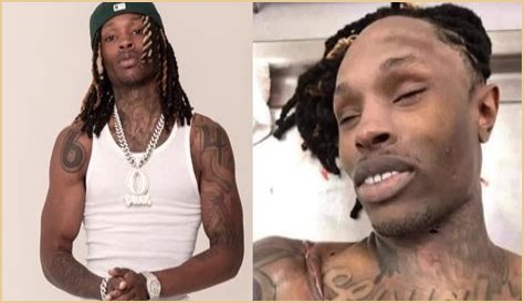 Unseen Autopsy Images Of King Von: The Tragic Aftermath Revealed